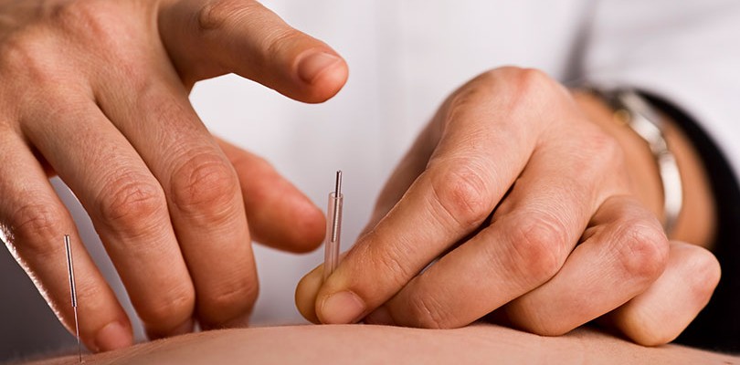 Acupuncture and Moxibustion